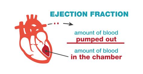 ef hjerte|Ejection Fraction: What It Is, Types and Normal Range